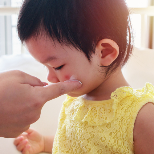 Przeciwalergiczne, przeciwzapalne Biotu.pl